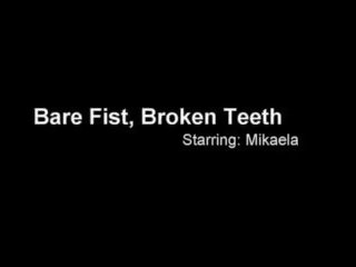 Bare fist broken teeth - cruel and deadly dangerous.